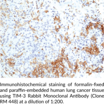 TIM-3 Rabbit Monoclonal Antibody (Clone RM448)