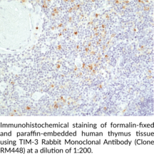 TIM-3 Rabbit Monoclonal Antibody (Clone RM448)