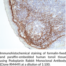 Podoplanin Rabbit Monoclonal Antibody (Clone RM449)