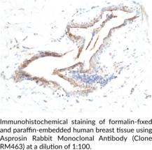 Asprosin Rabbit Monoclonal Antibody (Clone RM463)