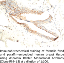 Asprosin Rabbit Monoclonal Antibody (Clone RM463)