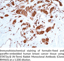 STAT3α/β (N-Term) Rabbit Monoclonal Antibody (Clone RM465)