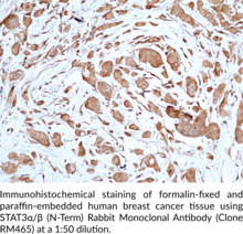 STAT3α/β (N-Term) Rabbit Monoclonal Antibody (Clone RM465)