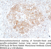 STAT3α/β (N-Term) Rabbit Monoclonal Antibody (Clone RM465)