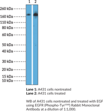 EGFR (Phospho-Tyr1068) Rabbit Monoclonal Antibody (Clone RM443) (Epidermal Growth Factor Receptor, ErbB-1, Erb-B2 Receptor Tyrosine Kinase 1, HER1)