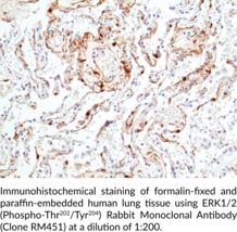 ERK1/2 (Phospho-Thr202/Tyr204) Rabbit Monoclonal Antibody (Clone RM451)