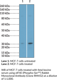eIF4E (Phospho-Ser209) Rabbit Monoclonal Antibody (Clone RM452) (Eukaryotic Translation Initiation Factor 4E, mRNA Cap-binding Protein)