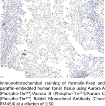 Aurora A (Phospho-Thr288)/Aurora B (Phospho-Thr232)/Aurora C (Phospho-Thr198) Rabbit Monoclonal Antibody (Clone RM454)