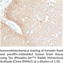 Tau (Phospho-Ser396) Rabbit Monoclonal Antibody (Clone RM461)
