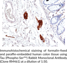 Tau (Phospho-Ser396) Rabbit Monoclonal Antibody (Clone RM461)