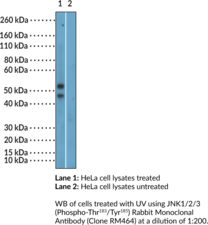 JNK1/2/3 (Phospho-Thr183/Tyr185) Rabbit Monoclonal Antibody (Clone RM464) (c-Jun N-terminal Kinase)