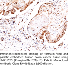 JNK1/2/3 (Phospho-Thr183/Tyr185) Rabbit Monoclonal Antibody (Clone RM464)