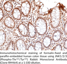 JNK1/2/3 (Phospho-Thr183/Tyr185) Rabbit Monoclonal Antibody (Clone RM464)