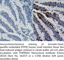 TMPRSS2 Monoclonal Antibody (Clone 3E10) (Epitheliasin, PRSS10, Serine Protease 10, Transmembrane Protease Serine 2, Transmembrane Serine Protease 2)