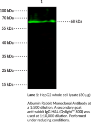 Albumin Rabbit Monoclonal Antibody (Clone 101) (HSA)