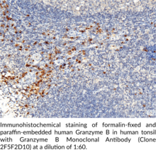 Granzyme B Monoclonal Antibody (Clone 2F5F2D10) (CTLA-1, Cytotoxic Serine Protease B, Cytotoxic T-lymphocyte Proteinase 2, Fragmentin-2, Granzyme-2, GrB)