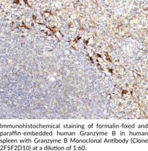 Granzyme B Monoclonal Antibody (Clone 2F5F2D10)
