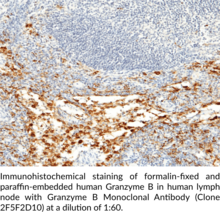 Granzyme B Monoclonal Antibody (Clone 2F5F2D10)