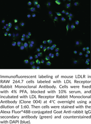 LDL Receptor Rabbit Monoclonal Antibody (Clone 004) (LDLR, Low Density Lipoprotein Receptor)