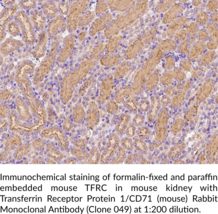 Transferrin Receptor Protein 1/CD71 (mouse) Rabbit Monoclonal Antibody (Clone 049)
