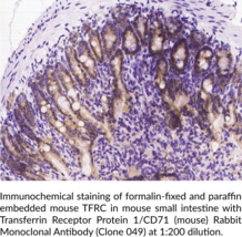 Transferrin Receptor Protein 1/CD71 (mouse) Rabbit Monoclonal Antibody (Clone 049)