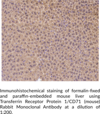 Transferrin Receptor Protein 1/CD71 (mouse) Rabbit Monoclonal Antibody (Clone 179) (Cluster of Differentiation 71, TfR1, TFRC, Transferrin Receptor Protein 1)