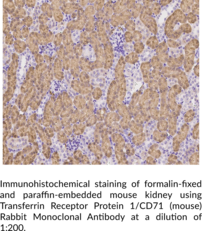 Transferrin Receptor Protein 1/CD71 (mouse) Rabbit Monoclonal Antibody (Clone 179)