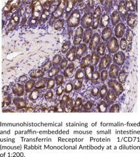 Transferrin Receptor Protein 1/CD71 (mouse) Rabbit Monoclonal Antibody (Clone 179)