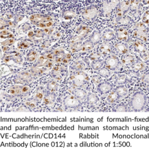 VE-Cadherin/CD144 Rabbit Monoclonal Antibody (Clone 012) (7B4 Antigen, Cadherin-5, Vascular Endothelial Cadherin)