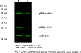 Cu/Zn SOD Monoclonal Antibody (Clone 11)