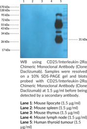 CD25/Interleukin-2Rα Chimeric Monoclonal Antibody (Clone Daclizumab) (Cluster of Differentiation 25, IL-2Rα, Interleukin-2 Receptor Subunit α, TAC Antigen)