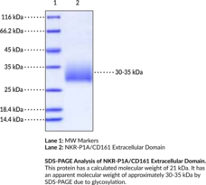 NKR-P1A/CD161 Extracellular Domain (mouse, recombinant) (CD161 Antigen-like Family Member A, Killer Cell Lectin-like Receptor Subfamily B Member 1A, KLRB1A, Natural Killer Cell Receptor P1A)