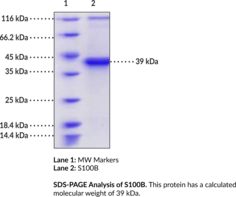 S100B (mouse, recombinant) (S100β, S100 Calcium-binding Protein B, S100 Protein β Chain, S100 Protein Subunit β)