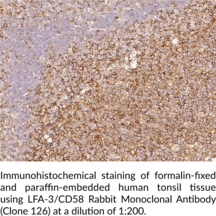 LFA-3/CD58 Rabbit Monoclonal Antibody (Clone 126) (Ag3, Lymphocyte Function Antigen 3, Lymphocyte Function-associated Antigen 3, Surface Glycoprotein LFA-3)