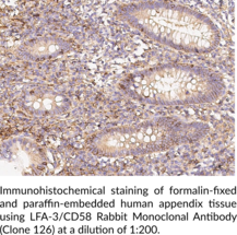 LFA-3/CD58 Rabbit Monoclonal Antibody (Clone 126)