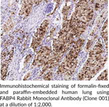 FABP4 Rabbit Monoclonal Antibody (Clone 001) (Adipocyte FABP, A-FABP, ALBP, aP2, Fatty Acid Binding Protein 4)