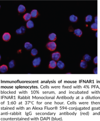 IFNAR1 Rabbit Monoclonal Antibody (Clone 110) (Interferon Alpha/Beta Receptor 1, Interferon α/β Receptor 1, CRF2-1, CRF2 member 1, Cytokine Receptor Class-II Member 1, Cytokine Receptor Family 2 Member 1, Type I IFN Receptor 1, Type I Interferon Receptor 1)