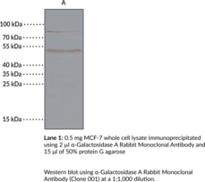 α-Galactosidase A Rabbit Monoclonal Antibody (Clone 001) (α-D-Galactoside Galactohydrolase, Galactosylgalactosylglucosylceramidase, GLA)