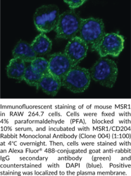 MSR1/CD204 Rabbit Monoclonal Antibody (Clone 004) (CD204, Macrophage Scavenger Receptor 1, SCARA1, SR-A)