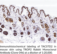 TROP2 Rabbit Monoclonal Antibody (Clone 046) (Cell Surface Glycoprotein TROP-2, Membrane Component 1 Surface Marker 1, M1S1, TACSTD2, Trophoblast Cell Surface Antigen 2, Tumor-Associated Calcium Signal Transducer 2)