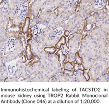 TROP2 Rabbit Monoclonal Antibody (Clone 046)