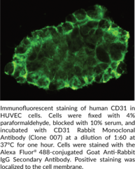 CD31 Rabbit Monoclonal Antibody (Clone 007) (Cluster of Differentiation 31, EndoCAM, GPIIA, PECA1, PECAM-1, Platelet Endothelial Cell Adhesion Molecule)
