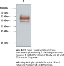 Asialoglycoprotein Receptor 1 Rabbit Polyclonal Antibody (ASGPR1, ASGR1, C-type Lectin Domain Family 4 Member H1, CLEC4H1, Hepatic Lectin H1, HL-1)
