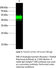 Asialoglycoprotein Receptor 1 Rabbit Polyclonal Antibody