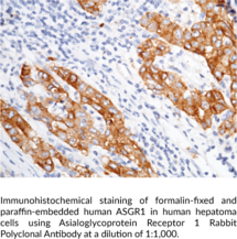 Asialoglycoprotein Receptor 1 Rabbit Polyclonal Antibody