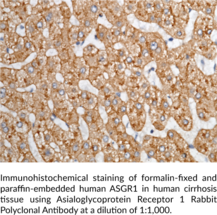 Asialoglycoprotein Receptor 1 Rabbit Polyclonal Antibody