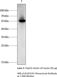 ALDH1A1 Monoclonal Antibody (Clone 5G9E6C9) (Aldehyde Dehydrogenase 1A1, RALDH1, Retinaldehyde Dehydrogenase 1)