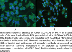 ALDH1A1 Monoclonal Antibody (Clone 5G9E6C9)