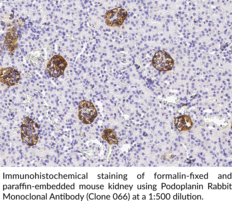 Podoplanin Rabbit Monoclonal Antibody (Clone 066) (Aggrus, gp38, T1A)
