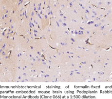 Podoplanin Rabbit Monoclonal Antibody (Clone 066)